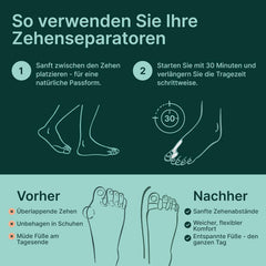 YOGAMEDIC silikonski razpiralci prstov za korekcijo hallux valgus - komplet 6 kosov