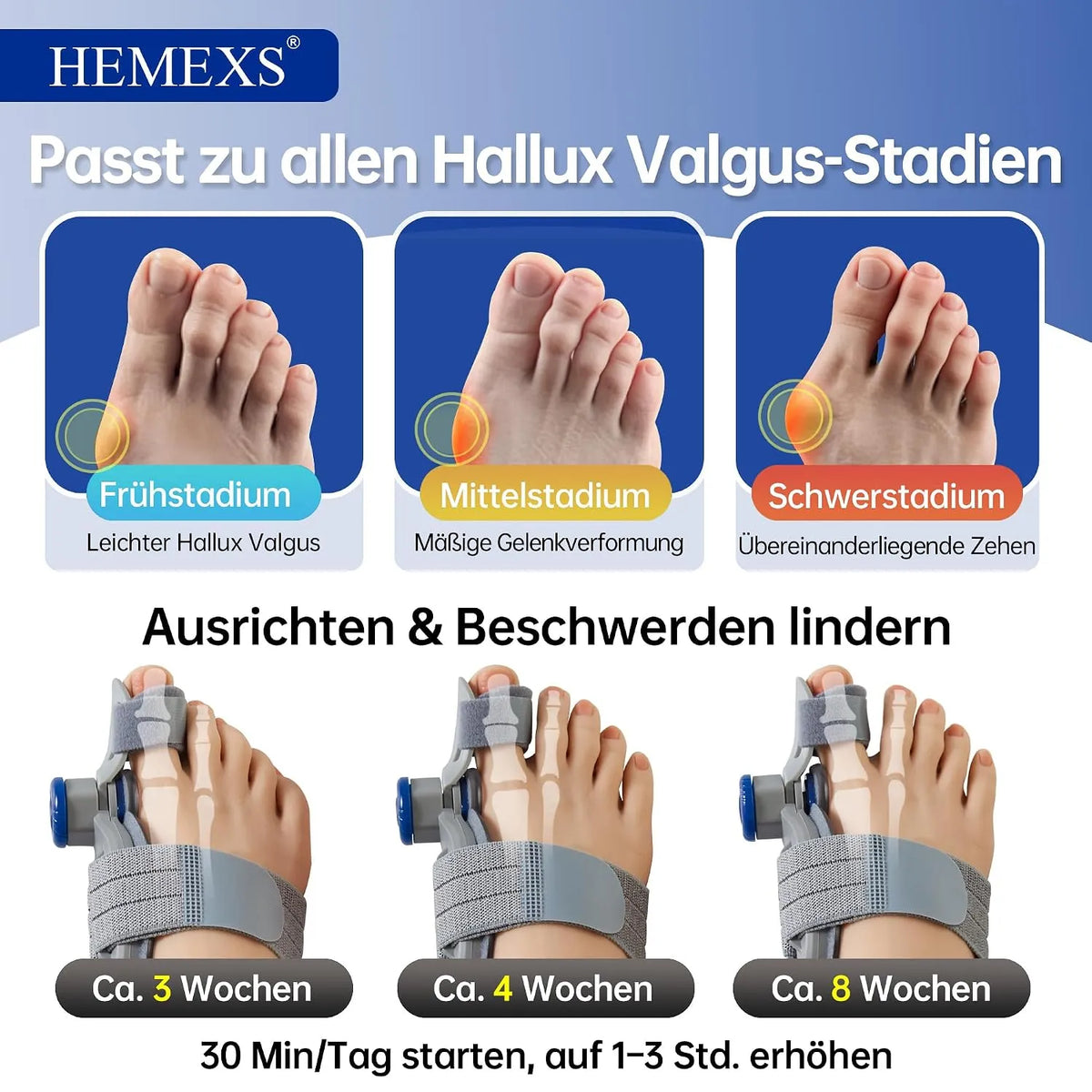 Korektor Za Nožne Prste In Hallux Valgus
