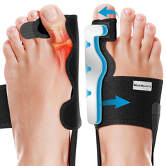 2x KATLEAY opornica za hallux valgus