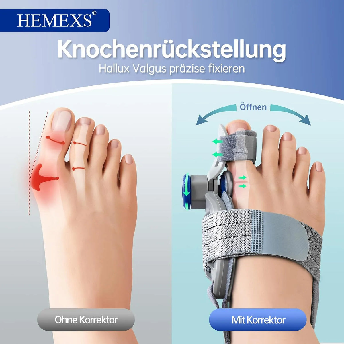 Korektor Za Nožne Prste In Hallux Valgus